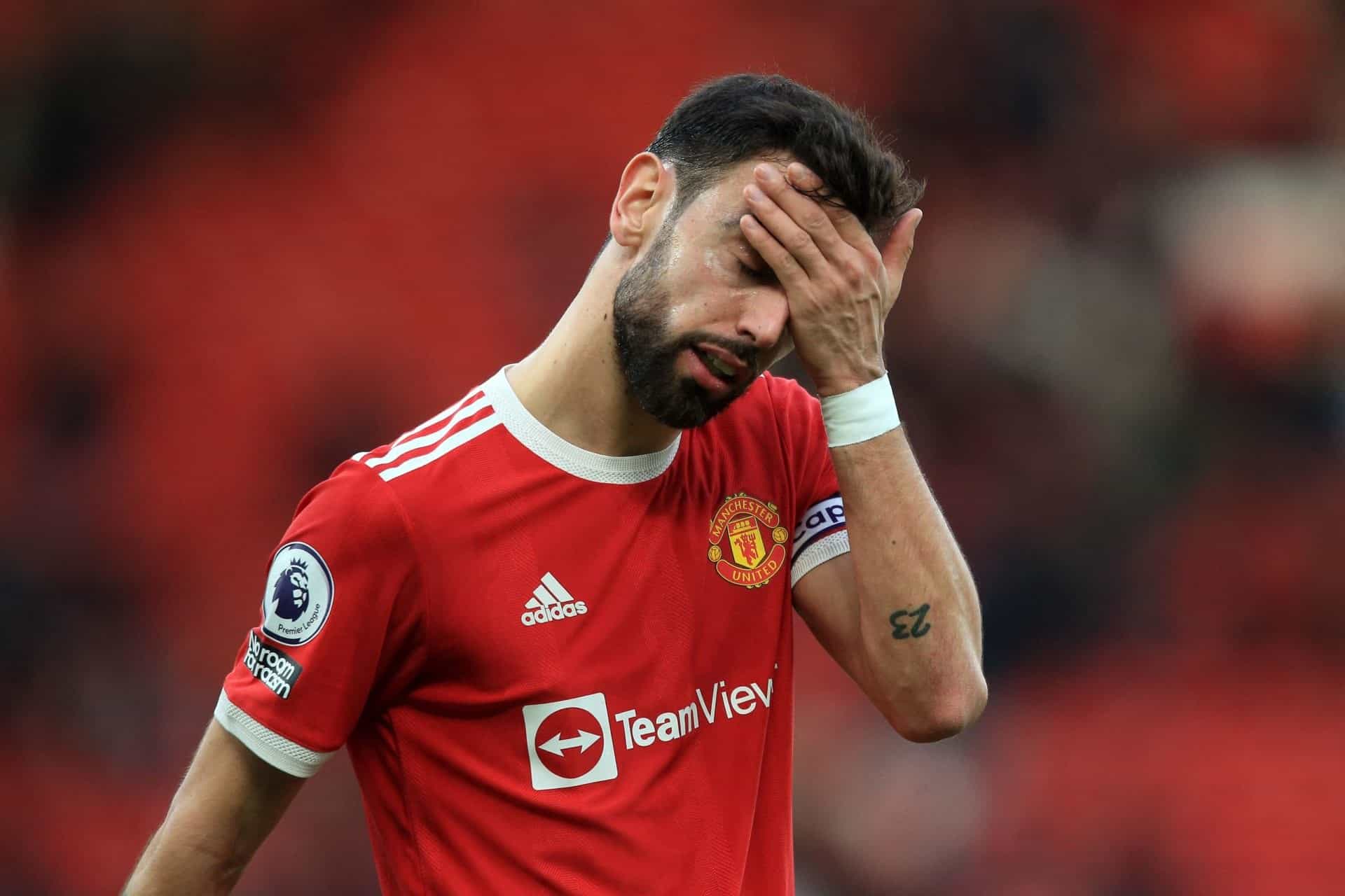 will manchester united bounce back against burnely?